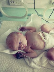 Malá se rozhodla přijít na svět koncem pánevním...